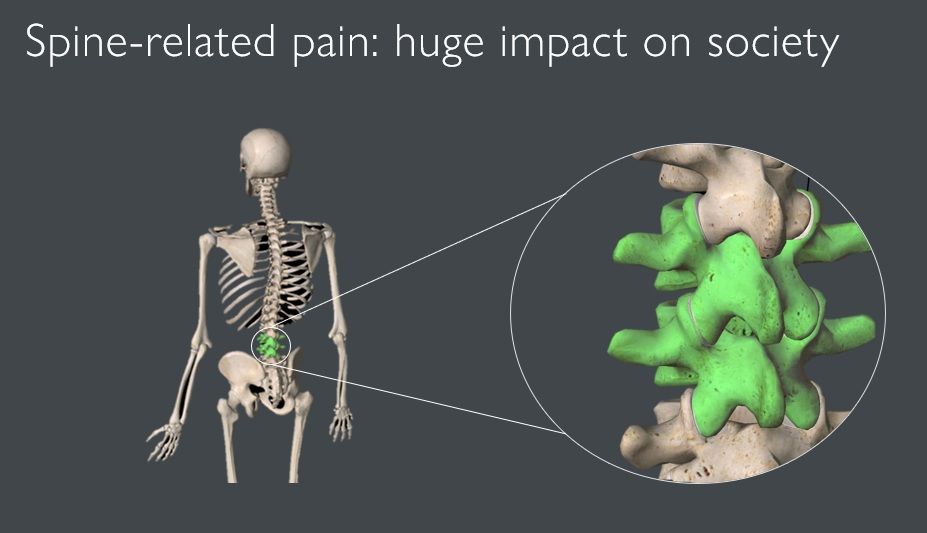 Visual van een skelet en ruggengraat met pijn